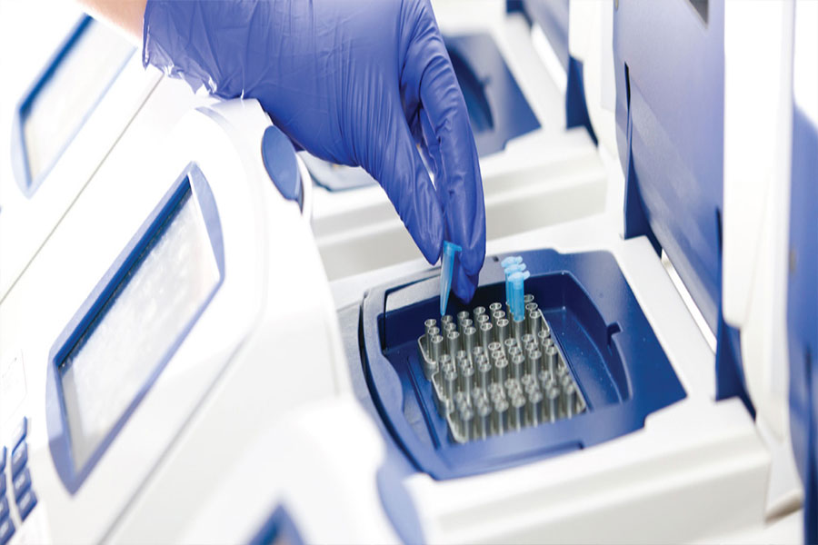 SneakPeek DNA Gender