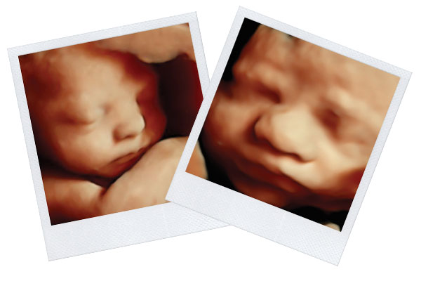 4D/HD Pregnancy Peek